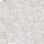 SLC16A2 Antibody in Immunohistochemistry (Paraffin) (IHC (P))