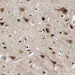 FBXO44 Antibody in Immunohistochemistry (Paraffin) (IHC (P))