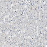 FBXO44 Antibody in Immunohistochemistry (Paraffin) (IHC (P))