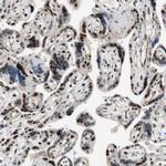 FBXO44 Antibody in Immunohistochemistry (Paraffin) (IHC (P))