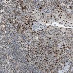 FBXO44 Antibody in Immunohistochemistry (Paraffin) (IHC (P))
