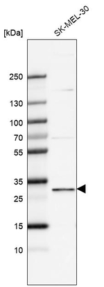 FBXO44 Antibody in Western Blot (WB)