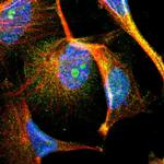 MBIP Polyclonal Antibody