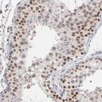 MBIP Antibody in Immunohistochemistry (Paraffin) (IHC (P))
