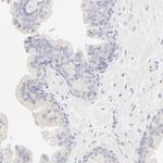 SPTB Antibody in Immunohistochemistry (Paraffin) (IHC (P))