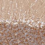 SPTB Antibody in Immunohistochemistry (Paraffin) (IHC (P))