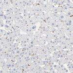 SPTB Antibody in Immunohistochemistry (Paraffin) (IHC (P))