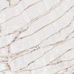 SPTB Antibody in Immunohistochemistry (Paraffin) (IHC (P))