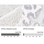 SPTB Antibody
