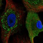 CKS2 Polyclonal Antibody