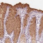 TFF1 Antibody in Immunohistochemistry (Paraffin) (IHC (P))