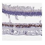 CHX10 Antibody in Immunohistochemistry (Paraffin) (IHC (P))