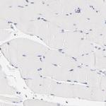 CHX10 Antibody in Immunohistochemistry (Paraffin) (IHC (P))