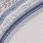 CHX10 Polyclonal Antibody