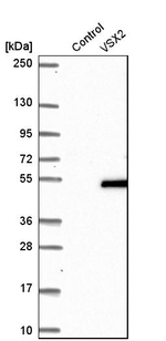 CHX10 Antibody in Western Blot (WB)