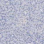ZEB2 Polyclonal Antibody