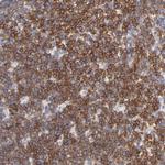 NTAL Antibody in Immunohistochemistry (Paraffin) (IHC (P))