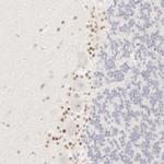 Nkx2.2 Polyclonal Antibody