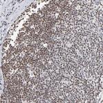 MAX Polyclonal Antibody