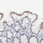 ELF3 Antibody in Immunohistochemistry (Paraffin) (IHC (P))