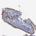 ELF3 Antibody in Immunohistochemistry (Paraffin) (IHC (P))