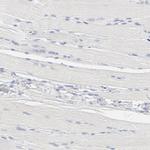 ELF3 Antibody in Immunohistochemistry (Paraffin) (IHC (P))