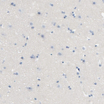 LCK Antibody in Immunohistochemistry (Paraffin) (IHC (P))