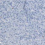 LCK Antibody in Immunohistochemistry (Paraffin) (IHC (P))