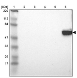 LCK Antibody in Western Blot (WB)