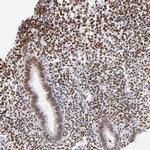 PBX1 Antibody in Immunohistochemistry (Paraffin) (IHC (P))