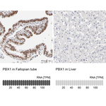 PBX1 Antibody in Immunohistochemistry (Paraffin) (IHC (P))