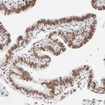 PBX1 Antibody in Immunohistochemistry (Paraffin) (IHC (P))