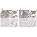 PBX1 Antibody in Immunohistochemistry (Paraffin) (IHC (P))