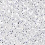 PBX1 Antibody in Immunohistochemistry (Paraffin) (IHC (P))