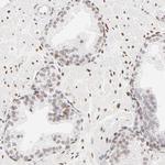 PBX1 Antibody in Immunohistochemistry (Paraffin) (IHC (P))