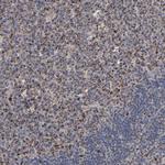 UQCRC1 Polyclonal Antibody