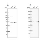 UQCRC1 Antibody in Western Blot (WB)