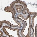 GPX2 Antibody in Immunohistochemistry (Paraffin) (IHC (P))