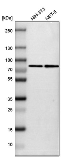 SETD3 Antibody in Western Blot (WB)