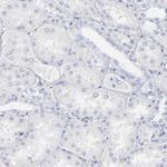 Arginase 1 Antibody in Immunohistochemistry (Paraffin) (IHC (P))