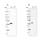 Arginase 1 Antibody in Western Blot (WB)