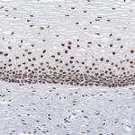 Bub3 Antibody in Immunohistochemistry (Paraffin) (IHC (P))