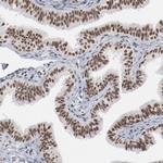 Bub3 Antibody in Immunohistochemistry (Paraffin) (IHC (P))