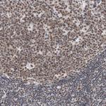Bub3 Antibody in Immunohistochemistry (Paraffin) (IHC (P))