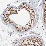 Bub3 Antibody in Immunohistochemistry (Paraffin) (IHC (P))