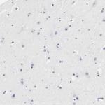 SERPINA4 Antibody in Immunohistochemistry (Paraffin) (IHC (P))