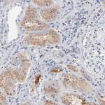 SERPINA4 Polyclonal Antibody