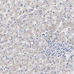 SERPINA4 Antibody in Immunohistochemistry (Paraffin) (IHC (P))