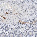 SERPINA4 Antibody in Immunohistochemistry (Paraffin) (IHC (P))
