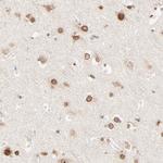 MAD1 Polyclonal Antibody